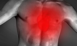 ilustrasi gejala penyakit serangan jantung