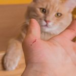 Cat Scratch Disease