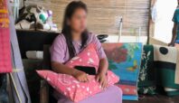 Perempuan di Serpong, Tangsel, mengaku dianiaya suami siri. Akibatnya ia mengalami luka di kepala hingga lengan. Foto: Andre Pradana/Tangselife