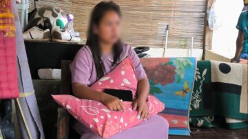 Perempuan di Serpong, Tangsel, mengaku dianiaya suami siri. Akibatnya ia mengalami luka di kepala hingga lengan. Foto: Andre Pradana/Tangselife