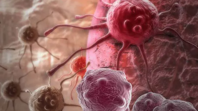 Cegah kanker dengan makanan yang tinggi akrimalida